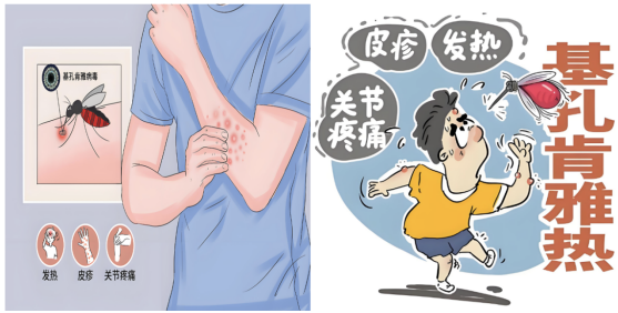 什么是基孔肯雅热？