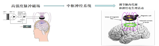 大脑的“电磁按摩” 认识重复经颅磁刺激（rTMS）