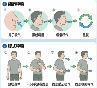 脑梗死最容易被忽略的后遗症：心肺功能废用性减退